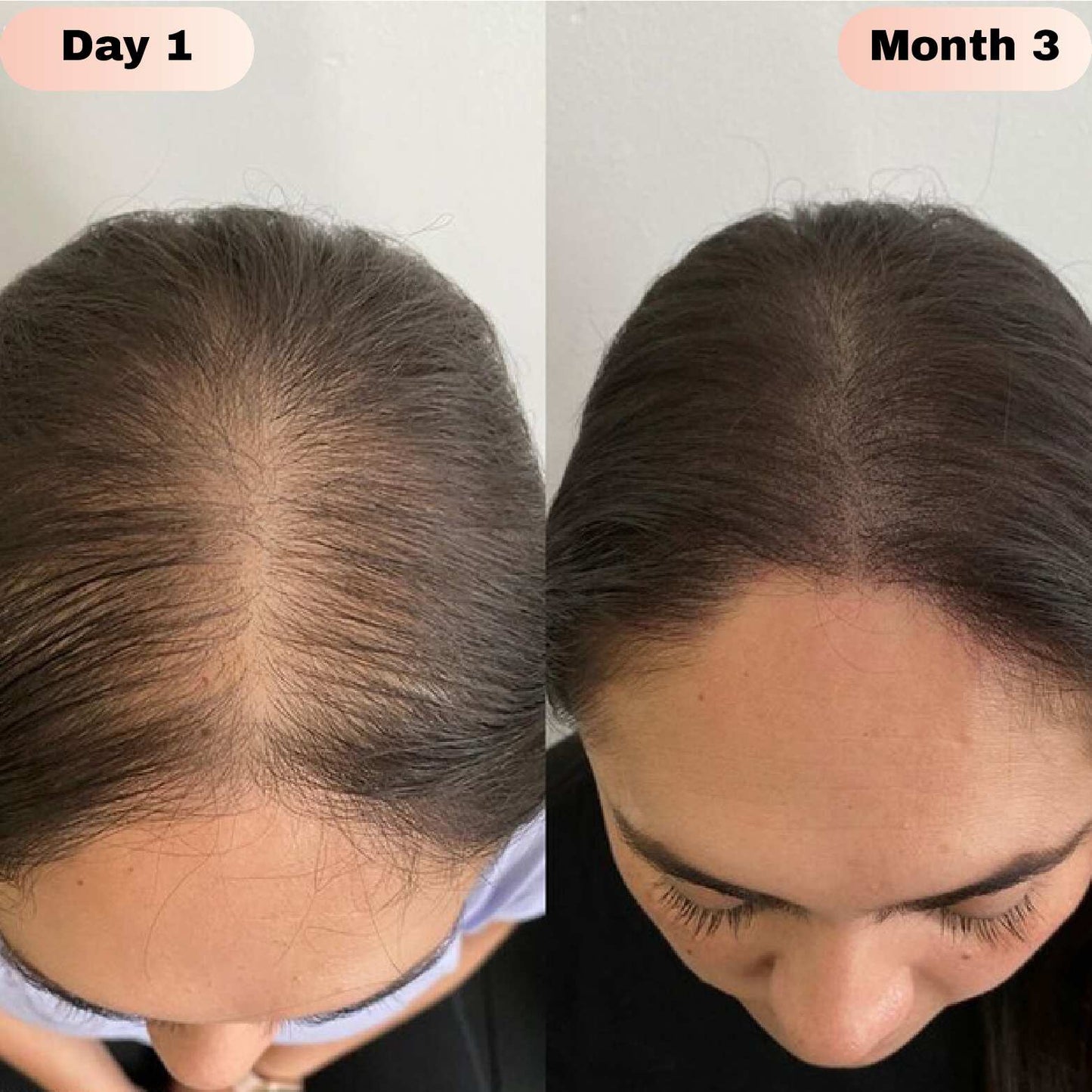 Velliora™ Advanced Hair Growth Roll On Serum - Velliora™